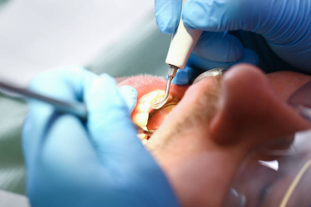 Best Dentist for Tooth Abscess  in Lagrange, GA