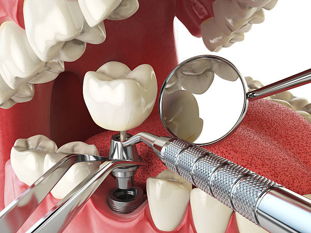 Best Urgent Tooth Repair  in Lagrange, GA